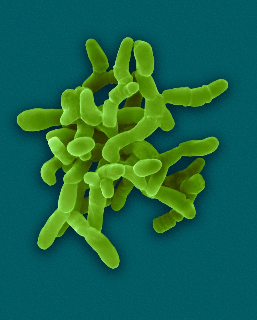Mycobacterium Avium spp Paratuberculosis. Scanning Electron Micrograph 3000X. Courtesy of Dennis Kunkel's Science Photo Library.