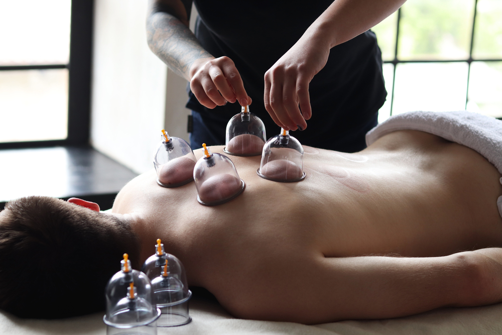 https://holisticprimarycare.net/wp-content/uploads/2022/11/P.8INSIDE-Cupping-therapy.jpg